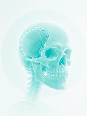 Reconstruções cranianas