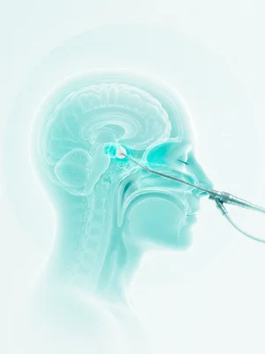 Endoscopia endonasal
