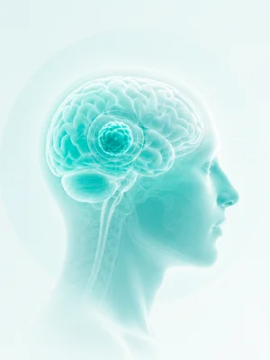 Neuro-oncologia e tumores cerebrais