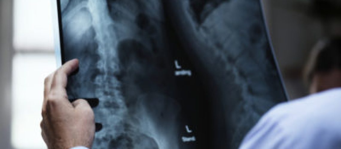 A doctor with a patient's x-ray film